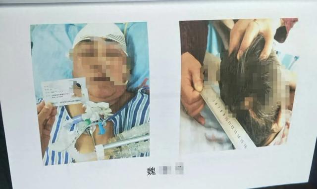 女子目睹母亲被撞飞，瞬间悲剧导致受惊吓身亡的悲剧瞬间